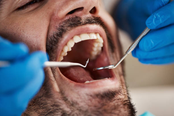 Best Dentist for Tooth Abscess  in Salina, KS